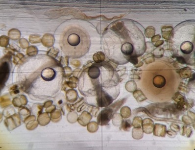 Mackerel eggs in various stages of development